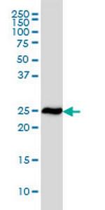 RPL19 Monoclonal Antibody (3H4)
