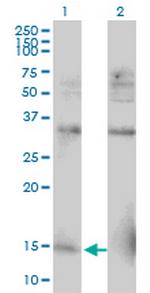RPL30 Monoclonal Antibody (2F6)