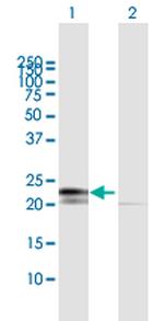 RPL29 Antibody in Western Blot (WB)