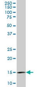 RPL36A Monoclonal Antibody (5F8)