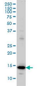 RPL36A Monoclonal Antibody (6H1)
