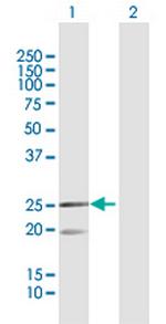 MRPL12 Polyclonal Antibody, MaxPab™