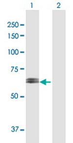 RPN2 Polyclonal Antibody, MaxPab™