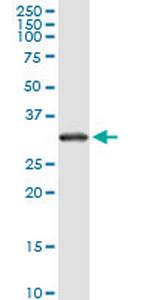 RPS2 Monoclonal Antibody (3G6)
