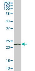 RPS5 Monoclonal Antibody (3G3)