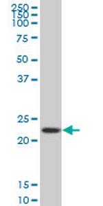 RPS5 Monoclonal Antibody (4H3)