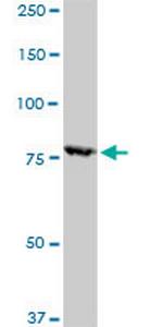 RPS6KA1 Antibody in Western Blot (WB)