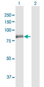 RPS6KA2 Antibody in Western Blot (WB)