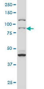 RPS6KA2 Monoclonal Antibody (1F6)