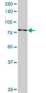 RPS6KA3 Monoclonal Antibody (2G10)