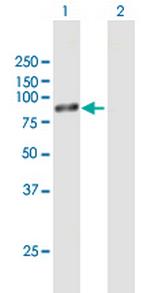 RPS6KB1 Antibody in Western Blot (WB)