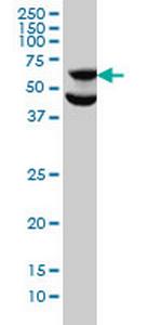 RPS6KB1 Antibody in Western Blot (WB)