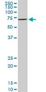 RPS6KB1 Antibody in Western Blot (WB)
