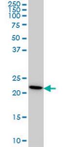 RPS7 Monoclonal Antibody (3G4)