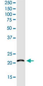 RPS7 Monoclonal Antibody (3G4)