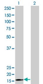 RPS15 Monoclonal Antibody (4H8)
