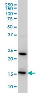 RPS17 Monoclonal Antibody (2C7)