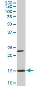 RPS17 Antibody in Western Blot (WB)