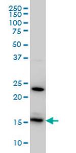 RPS17 Antibody in Western Blot (WB)
