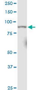 RRM1 Monoclonal Antibody (1D6)