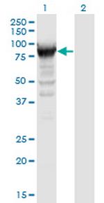 RRM1 Monoclonal Antibody (2E6)