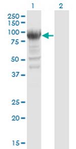 RRM1 Monoclonal Antibody (2G6)
