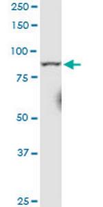 RRM1 Monoclonal Antibody (2D11)