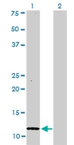 S100A1 Monoclonal Antibody (1D5)