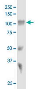 SORT1 Monoclonal Antibody (1B3)