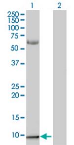 S100A2 Polyclonal Antibody, MaxPab™