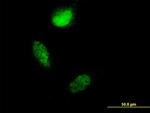 S100A4 Antibody in Immunocytochemistry (ICC/IF)