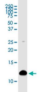 S100A4 Antibody in Western Blot (WB)