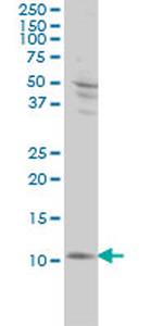 S100A4 Antibody in Western Blot (WB)