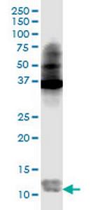 S100A4 Antibody in Western Blot (WB)
