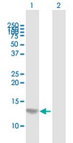 S100A7 Polyclonal Antibody, MaxPab™