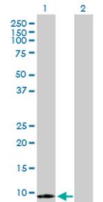 S100A7 Antibody in Western Blot (WB)