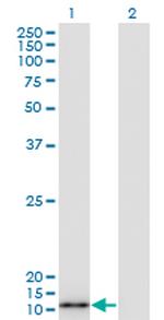 S100A7 Antibody in Western Blot (WB)