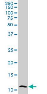 S100A7 Monoclonal Antibody (1F8)