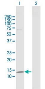 S100A8 Antibody in Western Blot (WB)