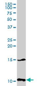 S100A8 Antibody in Western Blot (WB)