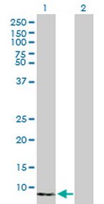 S100A8 Antibody in Western Blot (WB)