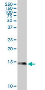 S100A9 Monoclonal Antibody (4G9)