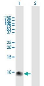 S100A12 Polyclonal Antibody, MaxPab™
