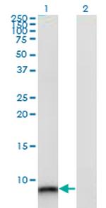 S100A12 Antibody in Western Blot (WB)
