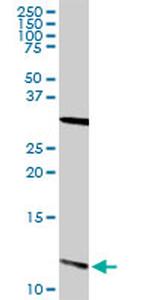 S100A13 Antibody in Western Blot (WB)