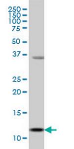 S100A13 Monoclonal Antibody (3A7)