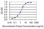 S100B Monoclonal Antibody (2A11)