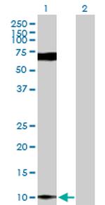 S100P Antibody in Western Blot (WB)
