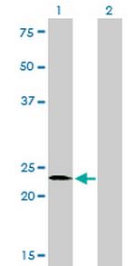 SALL2 Monoclonal Antibody (3F7)