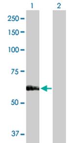 SARS Polyclonal Antibody, MaxPab™